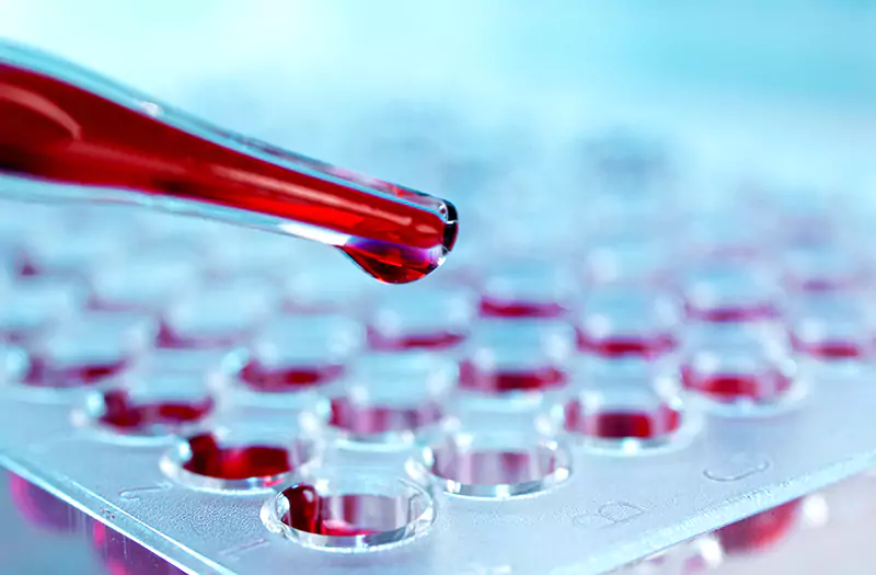 Complete Blood Count (CBC)